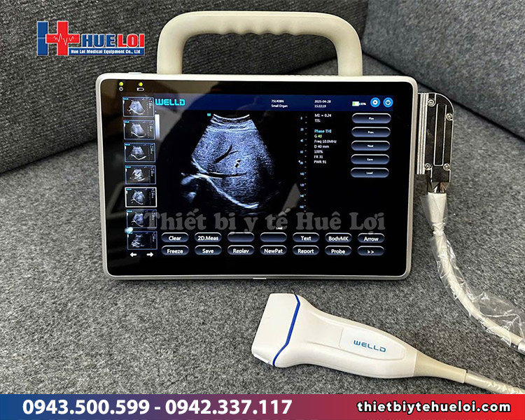 Máy siêu âm xách tay 2 đầu dò